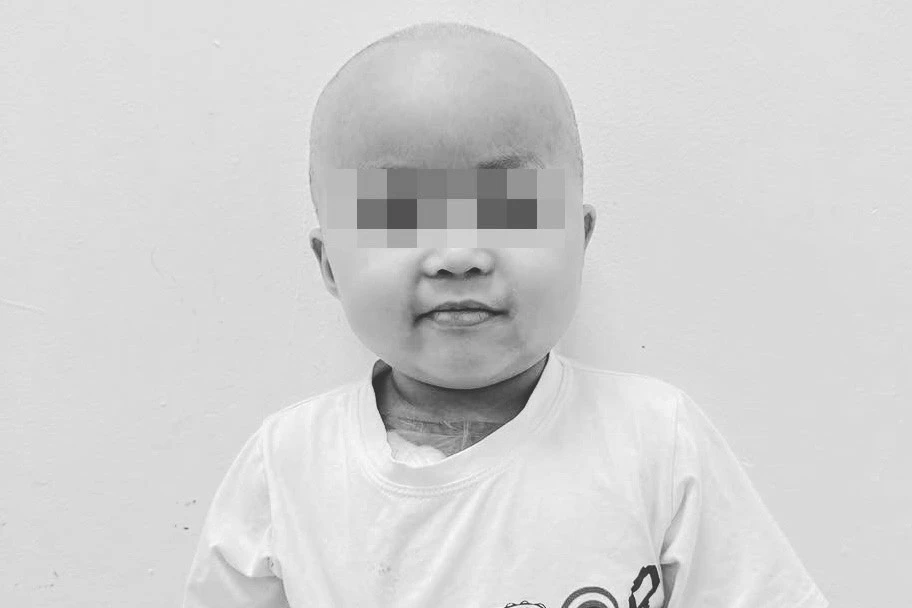 Bé Bắp qua đời sau hành trình kiên cường chiến đấu với bệnh ung thư 2 Bé Bắp qua đời sau thời gian chống chọi bệnh tật.