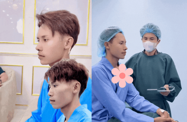 Anh đã sửa chiếc mũi to, gồ ghề và bị quặp xuống của mình sang dáng L-line