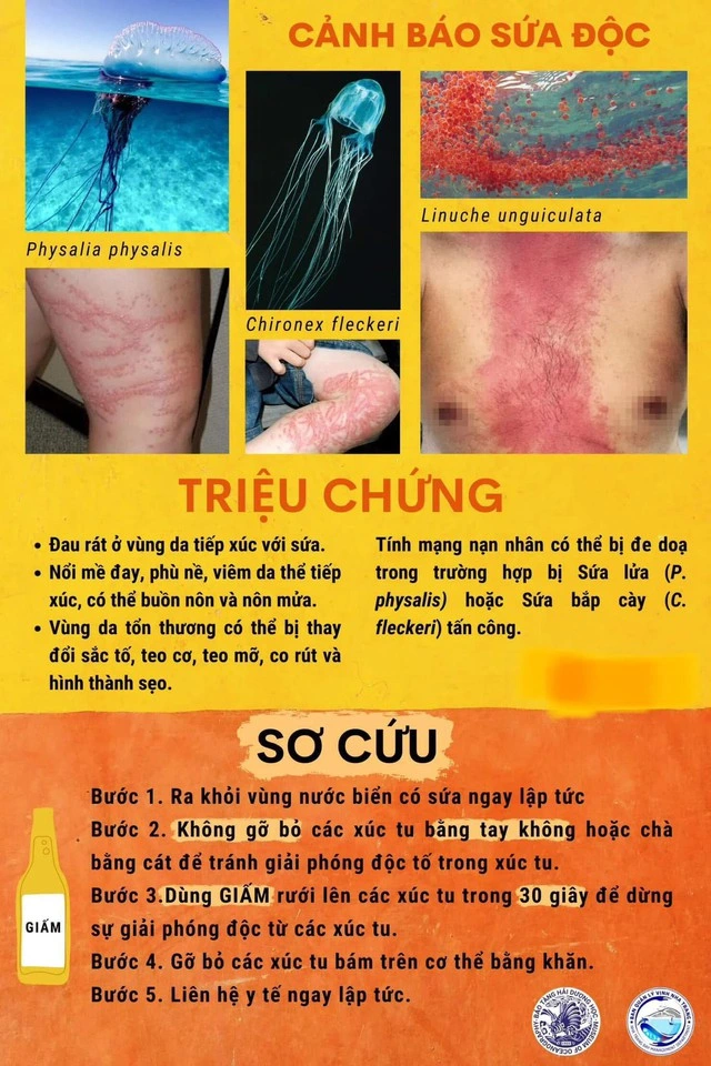 Sứa lửa xuất hiện tại bãi biển Nha Trang, Ban quản lý vịnh phát đi cảnh báo an toàn 1 Hướng dẫn sơ cứu khi bị sứa đốt của BQL vịnh Nha Trang